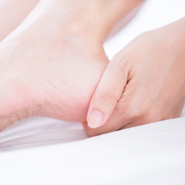 코와 20% 우레아 크림 건성 피부용 핸드 앤 풋 크림 60g