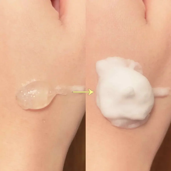 여드름 및 막힌 모공을 위한 에투세 젤리 무스 세안제 165g