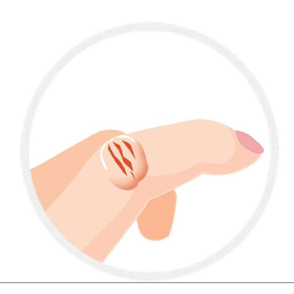 고바야시 사카무케아 액상붕대 손가락 흉터 케어 10g