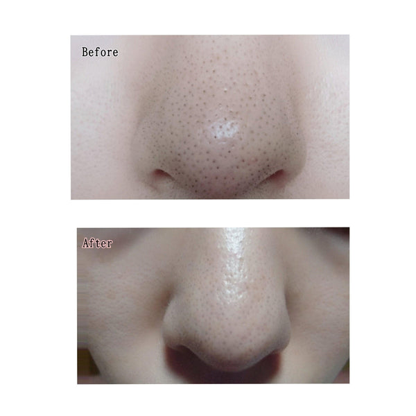 이츠카노 셋켄 효소 클렌징 비누 바 100g